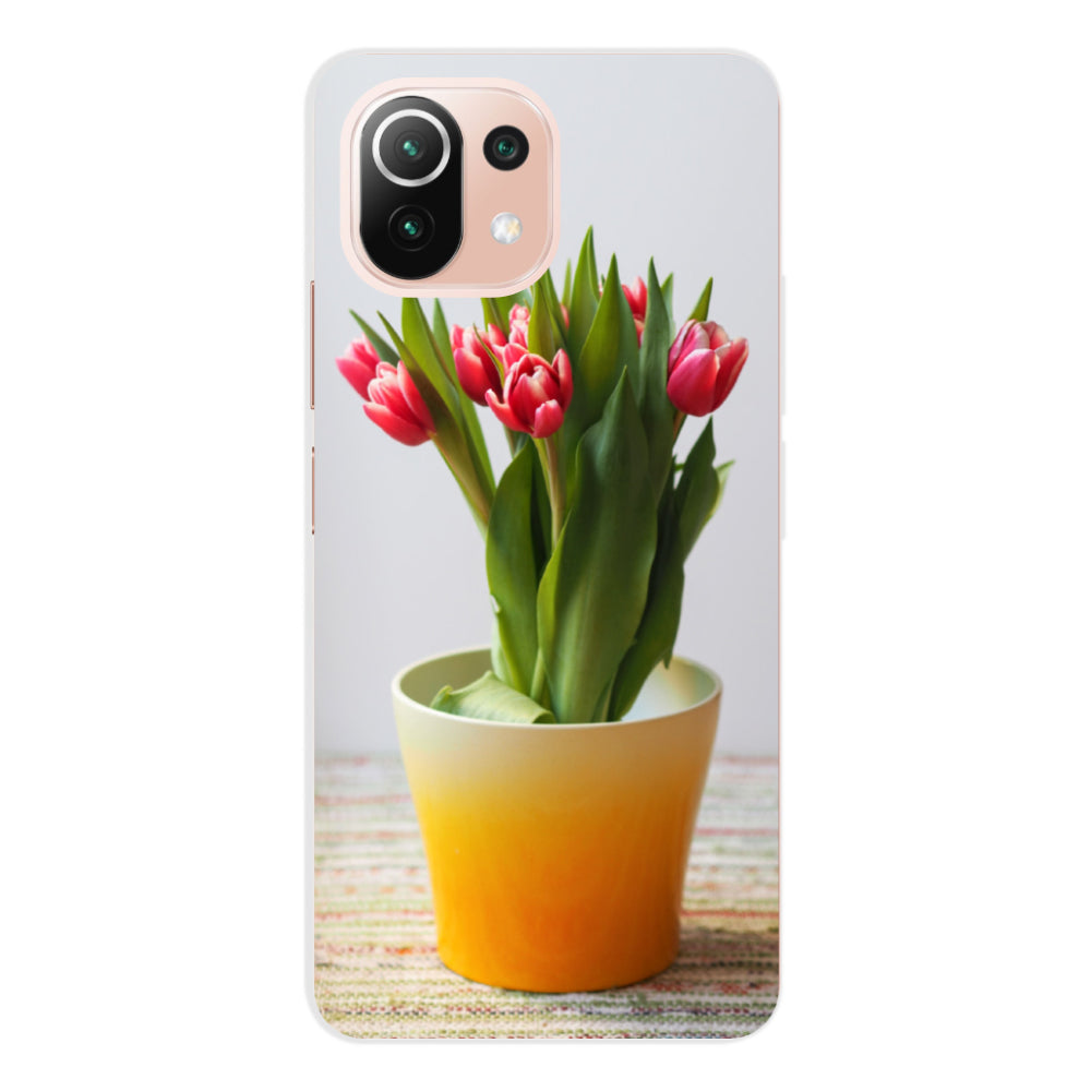 Telefoonhoesje Ontwerpen Xiaomi Mi 11 Lite met Foto's