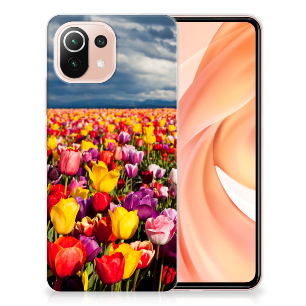Xiaomi Mi 11 Lite | 11 Lite 5G NE TPU Case Tulpen