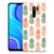 Xiaomi Redmi 9 Siliconen Case Ananas B2C Telecom
